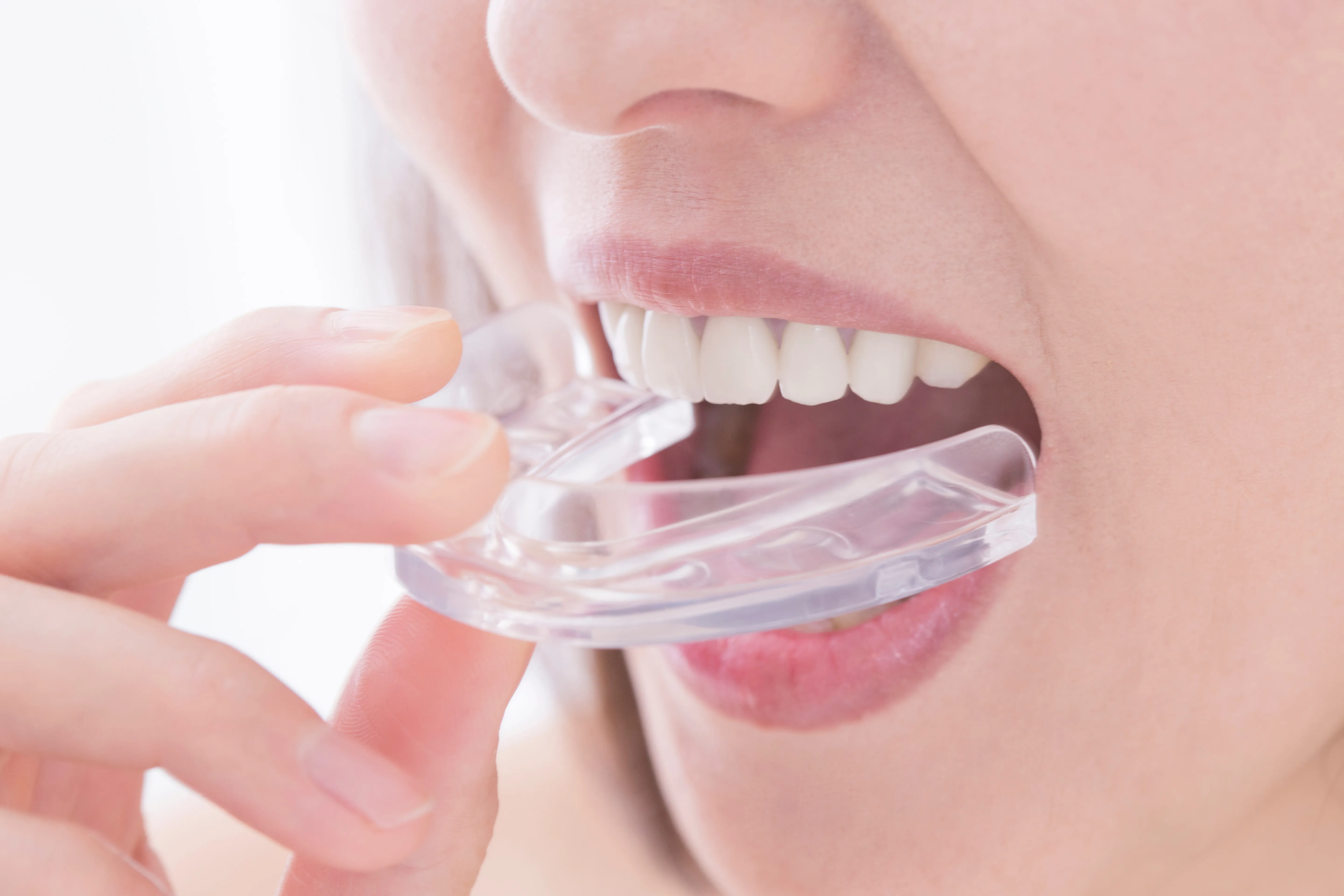 金属アレルギーでも安心